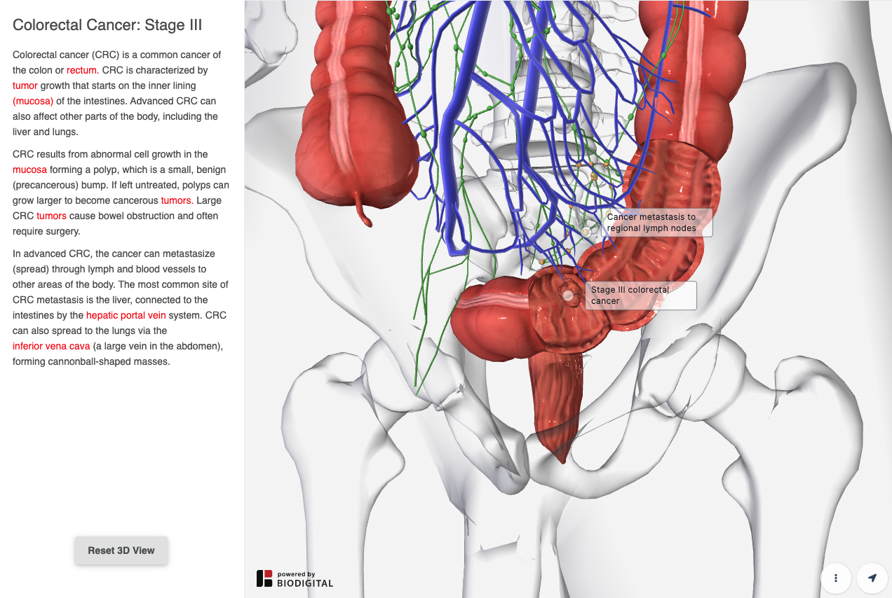 text-to-object mapping_nov23.png